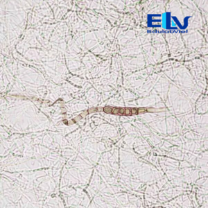 Tiêu bản Nấm Alternaria – Lam kính vi sinh cho giảng dạy