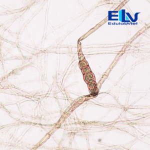 Tiêu bản Nấm Alternaria – Lam kính vi sinh cho giảng dạy