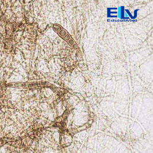 Tiêu bản Nấm Alternaria – Lam kính vi sinh cho giảng dạy