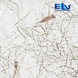 Tiêu bản Nấm Alternaria – Lam kính vi sinh cho giảng dạy