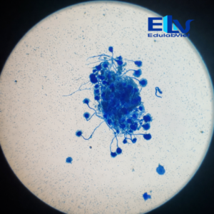 Tiêu Bản Nấm Aspergillus sp. – Tiêu Bản Hiển Vi Cố Định Nhuộm Màu Rõ Nét