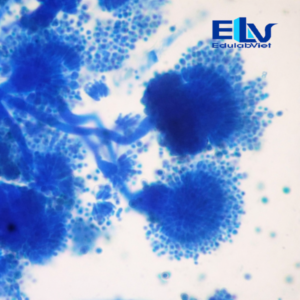 Tiêu Bản Nấm Aspergillus sp. – Tiêu Bản Hiển Vi Cố Định Nhuộm Màu Rõ Nét