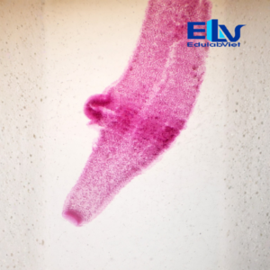 Tiêu Bản Thủy Tức (Hydra) – Tiêu Bản Hiển Vi Cố Định Quan Sát Cấu Tạo Ruột Khoang