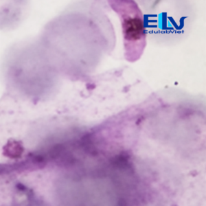 Tiêu bản ký sinh trùng sốt rét Plasmodium falciparum – Lam máu hiển vi chuẩn xét nghiệm