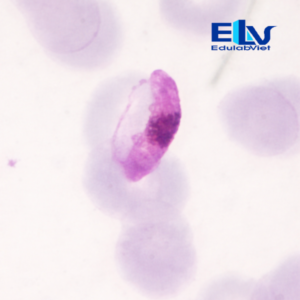 Tiêu bản ký sinh trùng sốt rét Plasmodium falciparum – Lam máu hiển vi chuẩn xét nghiệm