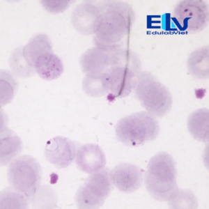 Tiêu bản ký sinh trùng sốt rét Plasmodium falciparum – Lam máu hiển vi chuẩn xét nghiệm