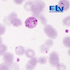 Tiêu bản ký sinh trùng sốt rét Plasmodium vivax – Lam máu hiển vi chuẩn phòng thí nghiệm