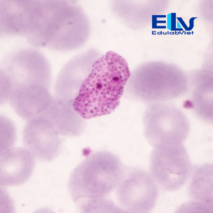 Tiêu bản ký sinh trùng sốt rét Plasmodium vivax – Lam máu hiển vi chuẩn phòng thí nghiệm