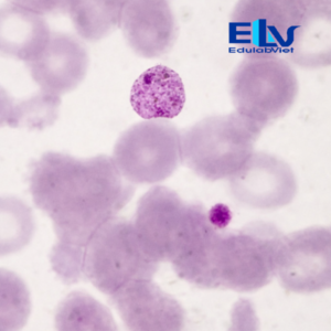 Tiêu bản ký sinh trùng sốt rét Plasmodium vivax – Lam máu hiển vi chuẩn phòng thí nghiệm