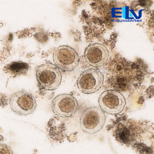 Tiêu bản Trứng giun đũa Ascaris lumbricoides – Lam kính hiển vi ký sinh trùng