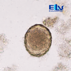 Tiêu bản Trứng giun đũa Ascaris lumbricoides – Lam kính hiển vi ký sinh trùng