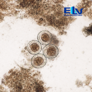 Tiêu bản Trứng giun đũa Ascaris lumbricoides – Lam kính hiển vi ký sinh trùng