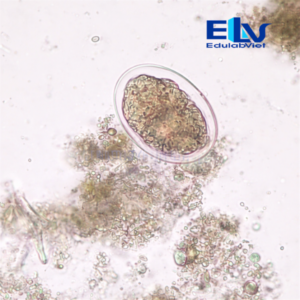 Tiêu bản Trứng giun móc Ancylostoma sp. – Lam kính hiển vi ký sinh trùng học