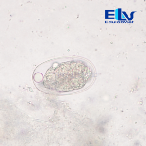 Tiêu bản Trứng giun móc Ancylostoma sp. – Lam kính hiển vi ký sinh trùng học