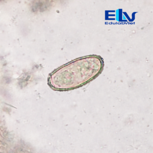 Tiêu Bản Trứng Sán Lá Gan Nhỏ Clonorchis sinensis – Tiêu Bản Ký Sinh Trùng Học