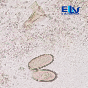 Tiêu Bản Trứng Sán Lá Gan Nhỏ Clonorchis sinensis – Tiêu Bản Ký Sinh Trùng Học