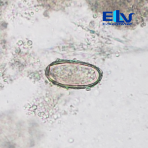 Tiêu Bản Trứng Sán Lá Gan Nhỏ Clonorchis sinensis – Tiêu Bản Ký Sinh Trùng Học