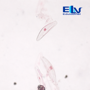 Tiêu bản tảo silic – Tiêu bản hiển vi vi tảo dùng cho giảng dạy