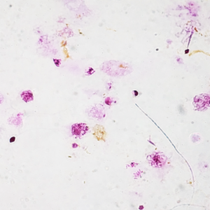 Tiêu Bản Giảm Phân Châu Chấu – Tiêu Bản Sinh Học Quan Sát Quá Trình Meiosis