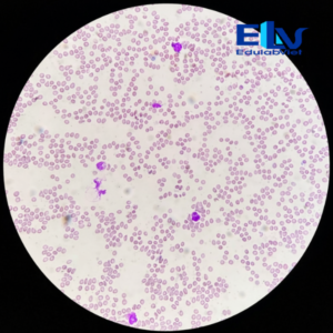 Tiêu bản máu người – Tiêu bản hiển vi quan sát tế bào máu