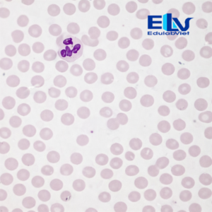 Tiêu bản máu người – Tiêu bản hiển vi quan sát tế bào máu
