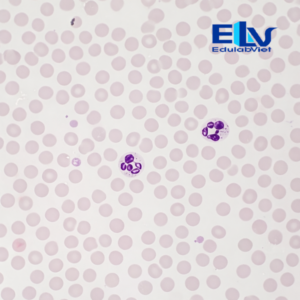 Tiêu bản máu người – Tiêu bản hiển vi quan sát tế bào máu