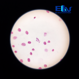 Tiêu bản nhiễm sắc thể rễ hành – Tiêu bản quan sát nhiễm sắc thể thực vật