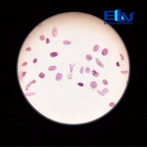 Tiêu bản nhiễm sắc thể rễ hành – Tiêu bản quan sát nhiễm sắc thể thực vật