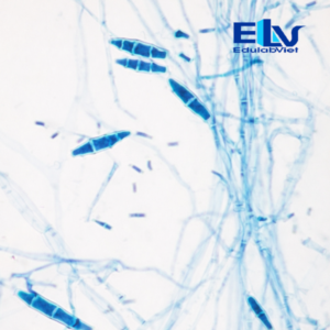 Tiêu bản nấm Microsporum gypseum – Lam kính hiển vi cố định chuẩn nấm học