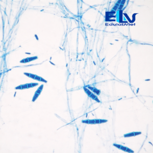 Tiêu bản nấm Microsporum gypseum – Lam kính hiển vi cố định chuẩn nấm học