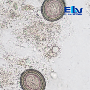 Tiêu bản Trứng sán dây heo Taenia solium – Lam kính ký sinh trùng học chuẩn phòng thí nghiệm
