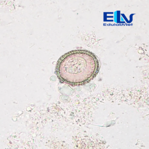 Tiêu bản Trứng sán dây heo Taenia solium – Lam kính ký sinh trùng học chuẩn phòng thí nghiệm