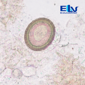 Tiêu bản Trứng sán dây heo Taenia solium – Lam kính ký sinh trùng học chuẩn phòng thí nghiệm