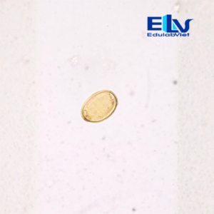 Tiêu bản trứng sán lá Dendriticum – Lam kính ký sinh trùng