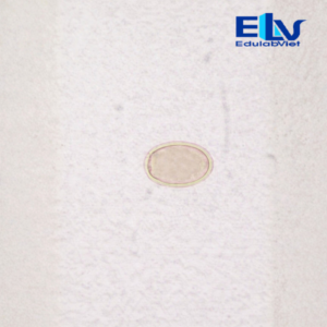 Tiêu bản trứng sán lá Dendriticum – Lam kính ký sinh trùng