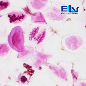 Tiêu bản giảm phân hoa hẹ – Tiêu bản hiển vi quan sát quá trình giảm phân