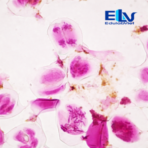 Tiêu bản giảm phân hoa hẹ – Tiêu bản hiển vi quan sát quá trình giảm phân