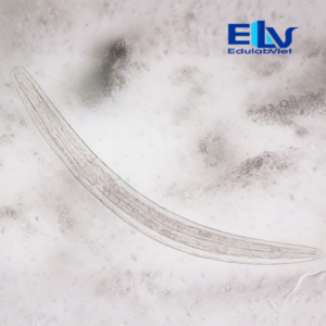 Tiêu Bản Ấu Trùng Giun Lươn Strongyloides stercoralis Giai Đoạn 2 – Tiêu Bản Ký Sinh Trùng Học