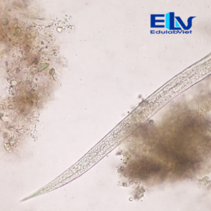 Tiêu Bản Ấu Trùng Giun Lươn Strongyloides stercoralis Giai Đoạn 2 – Tiêu Bản Ký Sinh Trùng Học