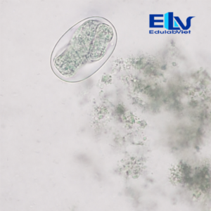 Tiêu bản trứng giun mỏ – Tiêu bản hiển vi ký sinh trùng dùng trong giảng dạy và nghiên cứu