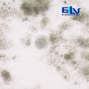 Tiêu bản trứng giun mỏ – Tiêu bản hiển vi ký sinh trùng dùng trong giảng dạy và nghiên cứu