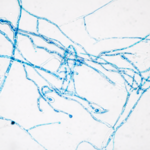 Tiêu bản nấm Nigrospora – Lam kính quan sát vi sinh vật
