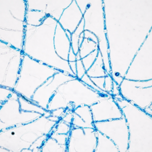 Tiêu bản nấm Nigrospora – Lam kính quan sát vi sinh vật