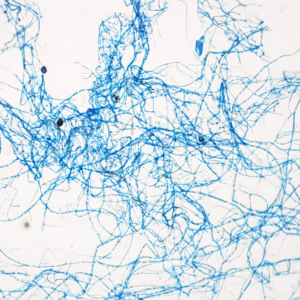 Tiêu bản nấm Nigrospora – Lam kính quan sát vi sinh vật