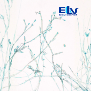 Tiêu bản nấm Cladosporium – Lam kính quan sát nấm sợi