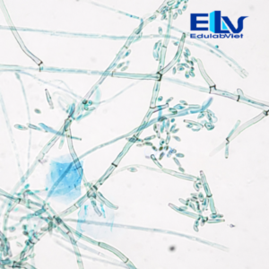 Tiêu bản nấm Cladosporium – Lam kính quan sát nấm sợi