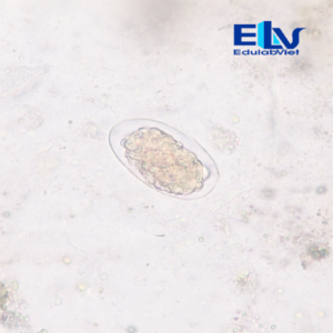 Tiêu bản trứng giun sán tổng hợp – Lam kính ký sinh trùng học