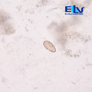 Tiêu bản trứng giun sán tổng hợp – Lam kính ký sinh trùng học