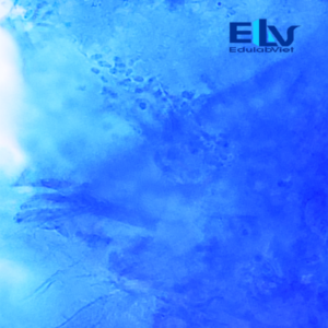 Tiêu bản bệnh phẩm lang ben – Lam kính nấm da