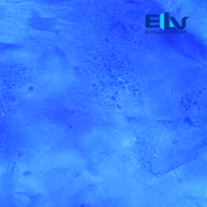 Tiêu bản bệnh phẩm lang ben – Lam kính nấm da